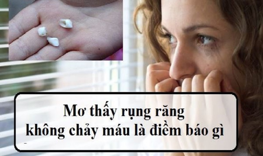 Mơ thấy rụng răng: Giải mã điềm báo và các tình huống cụ thể