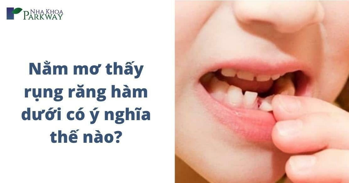 Nằm mơ thấy rụng răng hàm dưới là điềm báo gì, hên hay xui?