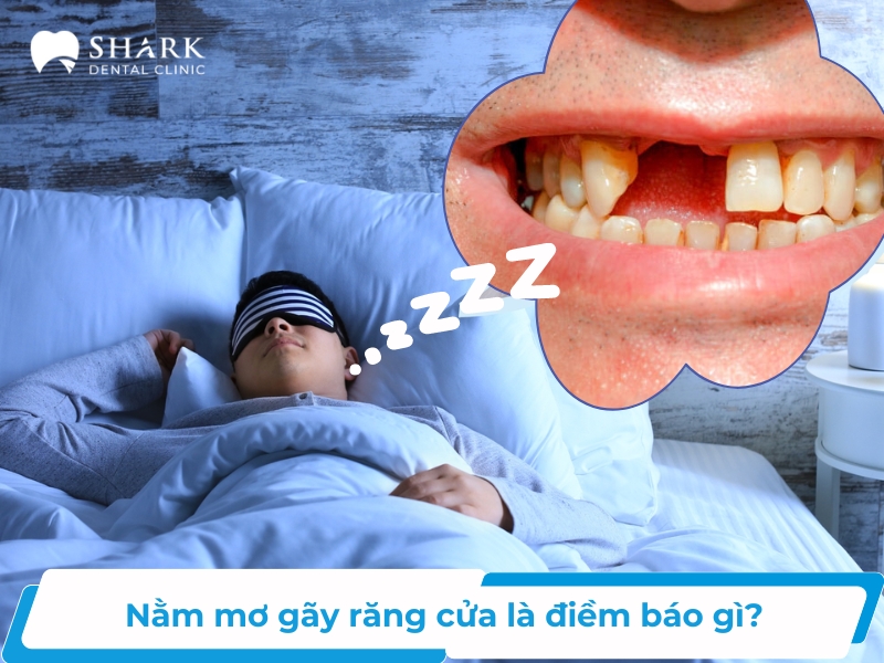 Nằm mơ gãy răng cửa báo hiệu điều gì? Cẩn thận những rủi ro