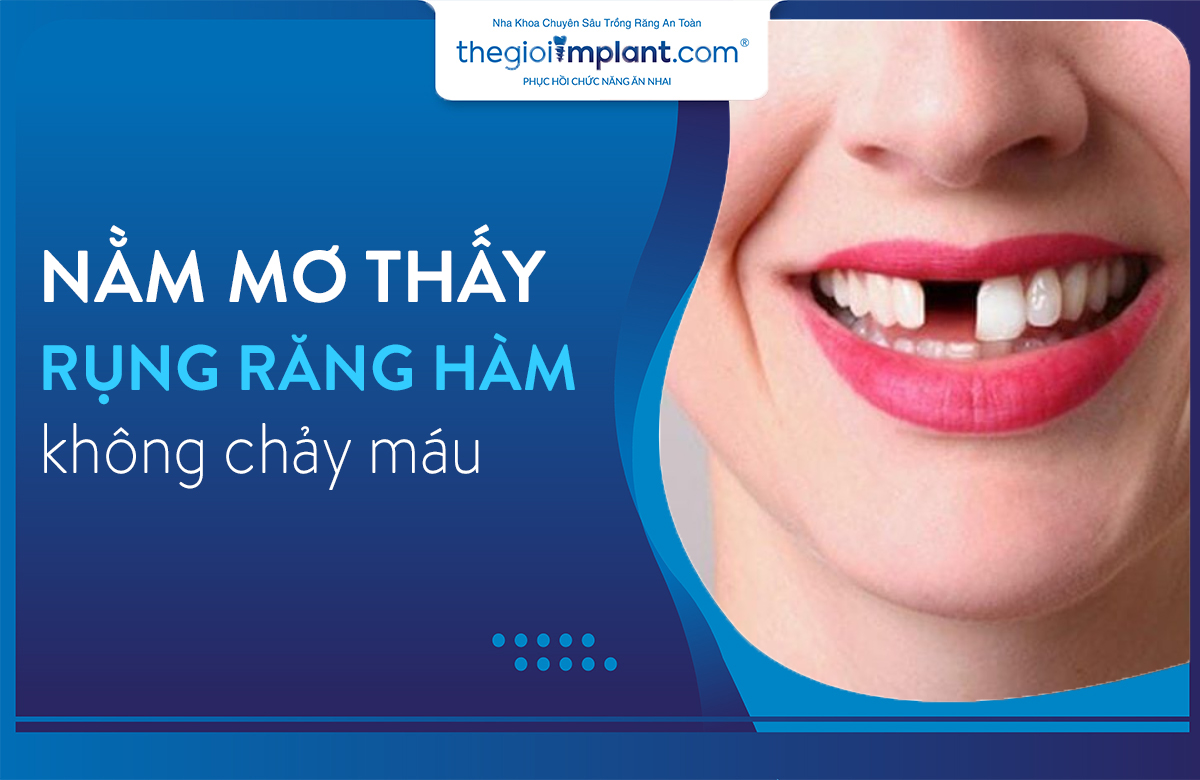 Nằm mơ thấy rụng răng hàm trên không chảy máu, liệu có phải sắp có tin vui?