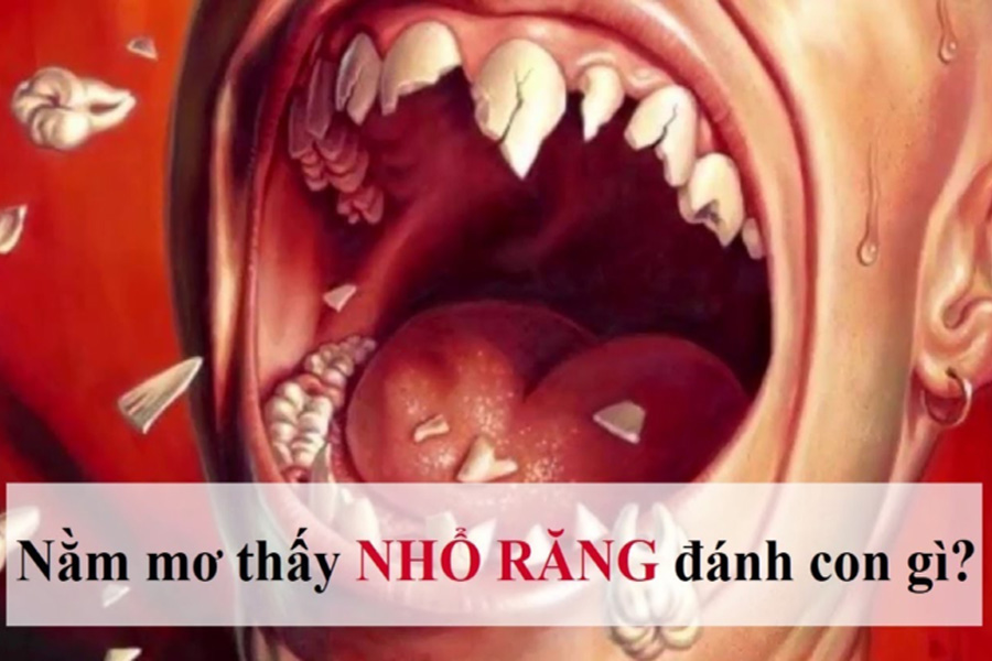 nằm mơ thấy bị nhổ răng chảy máu đánh số gì (May mắn hay xui rủi)